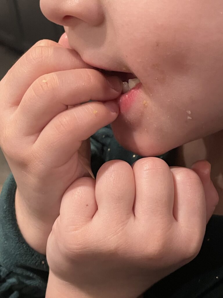 Teeth irritating child