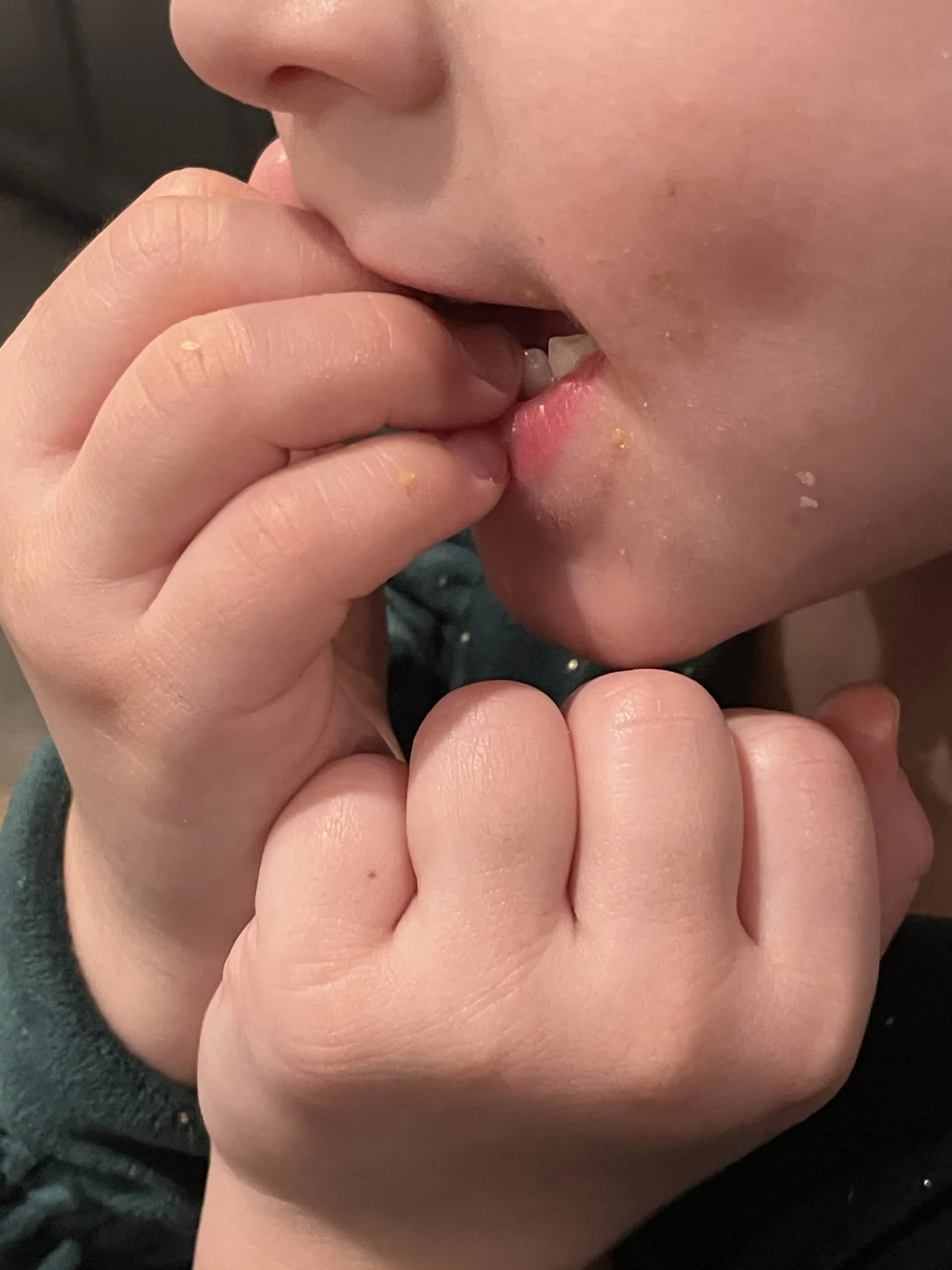 Teeth irritating child